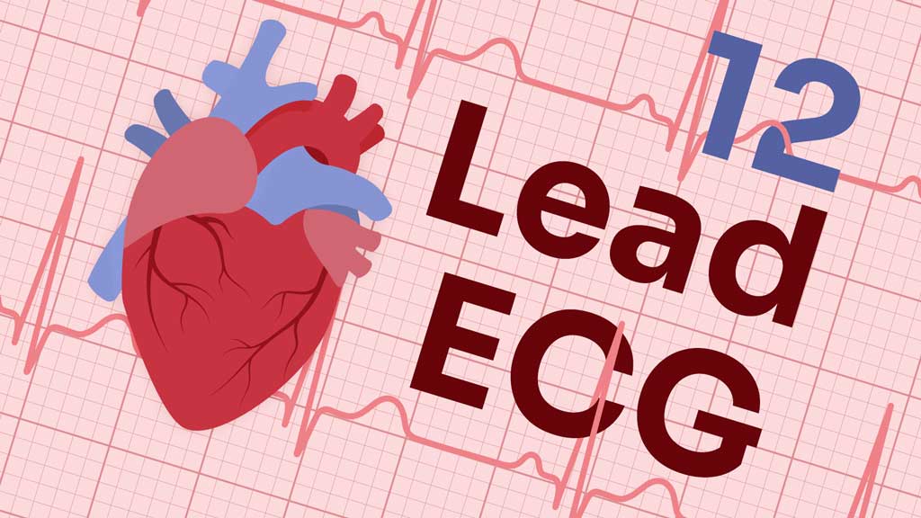 Are ECG Watches Accurate?