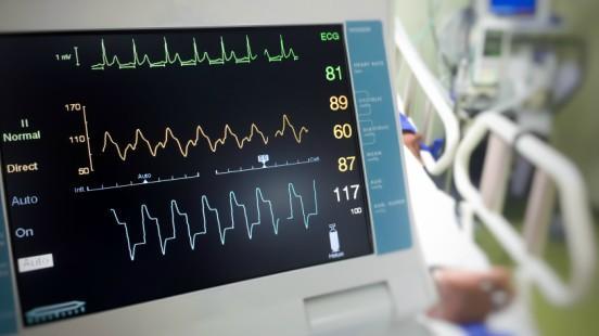 The Importance of ECG Monitoring in Modern Health Care?