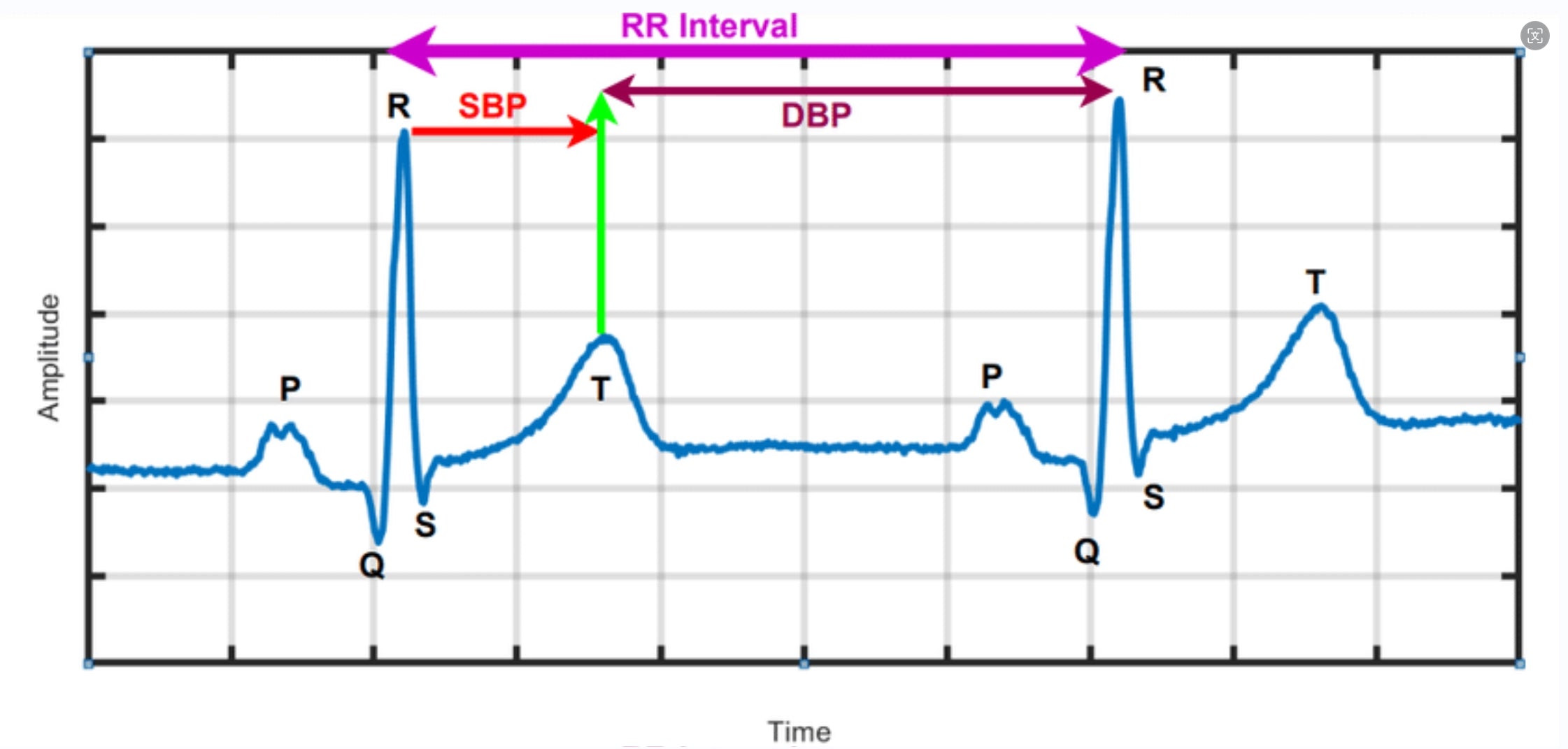 How Are Electrocardiogram (ECG) and Blood Pressure (BP)  Related?