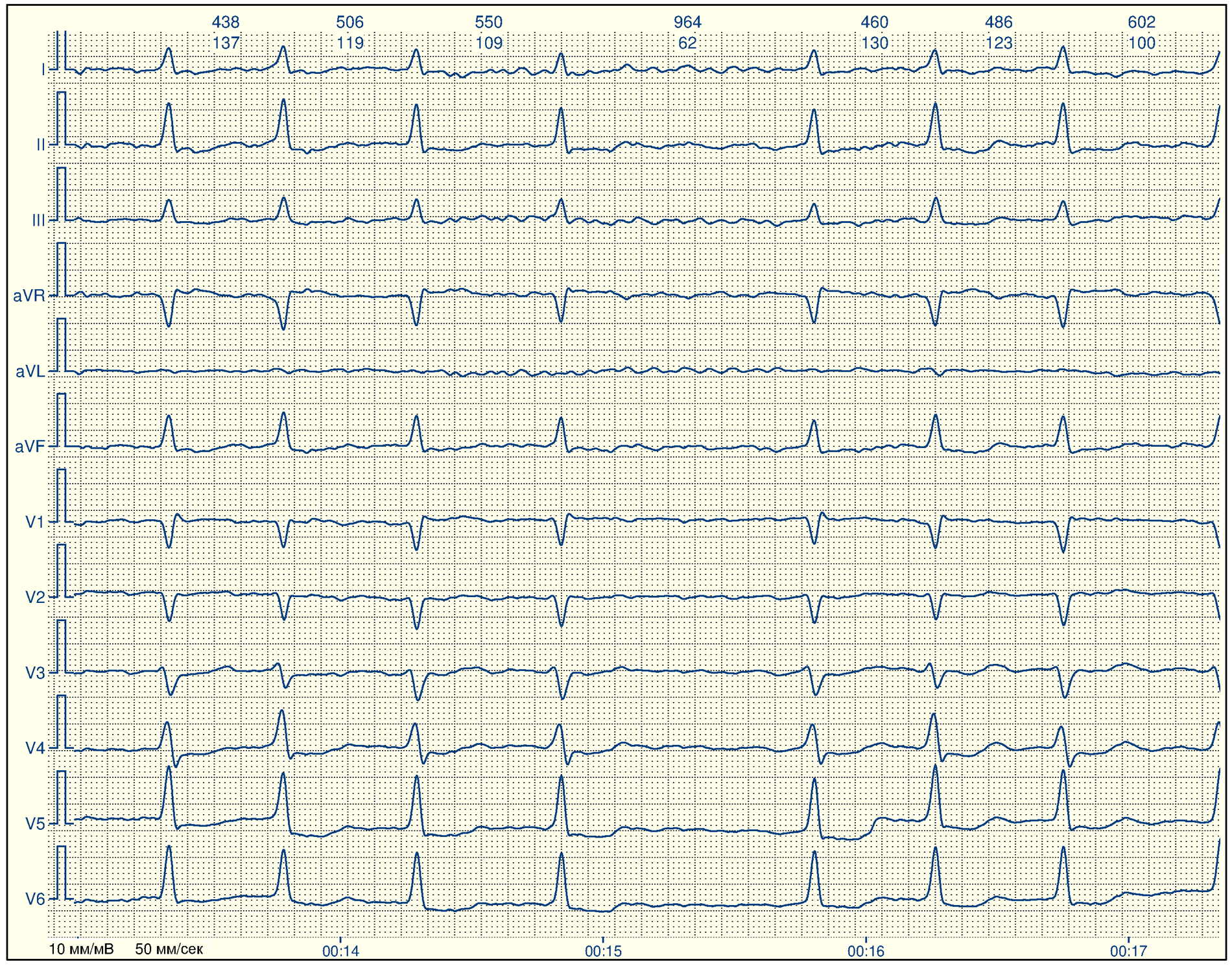 Understanding the Importance of Electrocardiogram (ECG) Examinations for Health