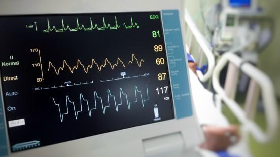 The Importance of ECG Monitoring in Modern Health Care？