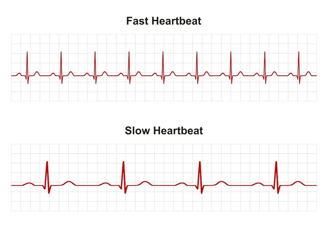 Unhealthy Electrocardiogram: What Are the Signs and How Can You Prevent Them?