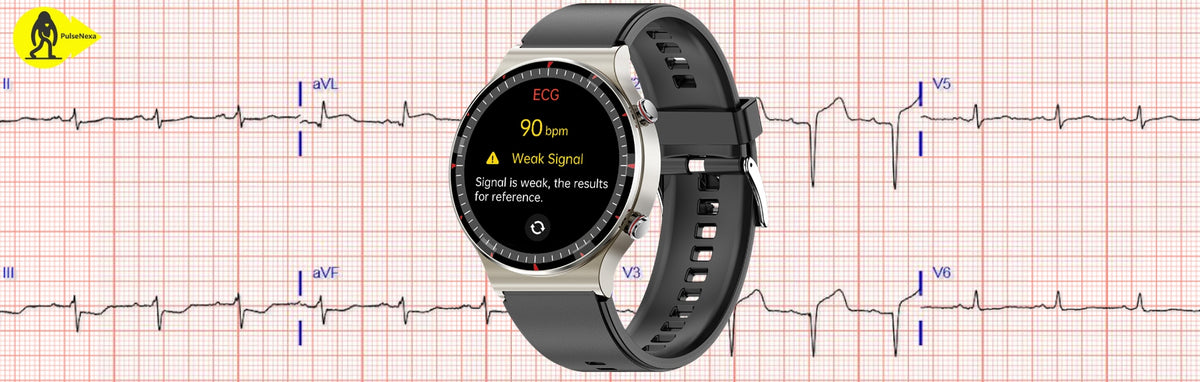 How Smartwatches with ECG Can Transform Heart Health Management ...