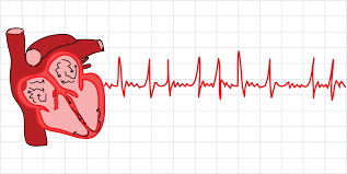 Detecting and Preventing AFib and VFib: How Smartwatches Can Help？