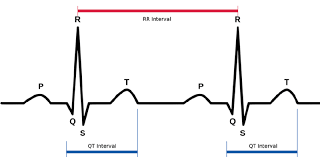 How ECG Monitoring Can Help Maintain a Healthy Lifestyle?